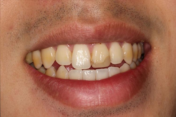 cosmetic dentist kitsilano point grey vancouver bc