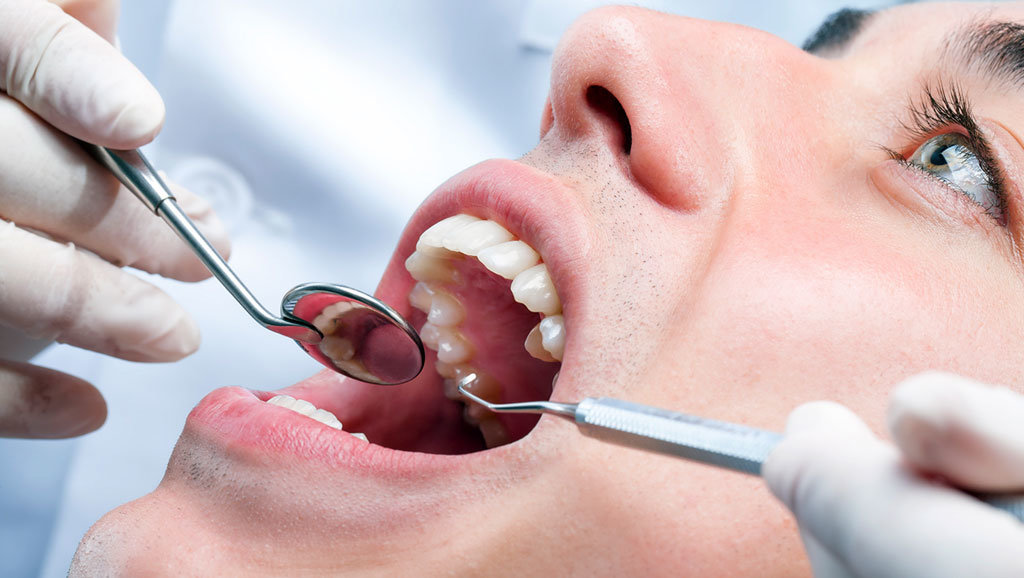 wisdom_teeth_removal