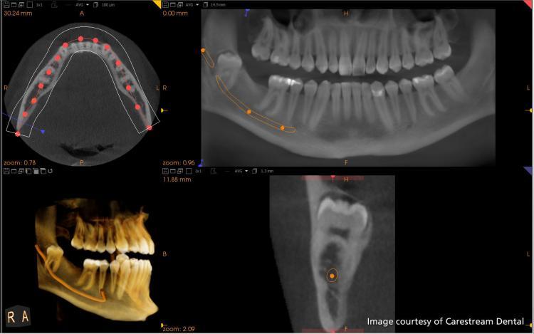 3D X-Ray/CT scan