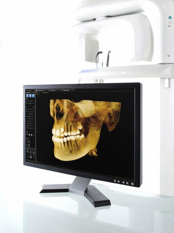 ct scans for dental procedure vancouver bc