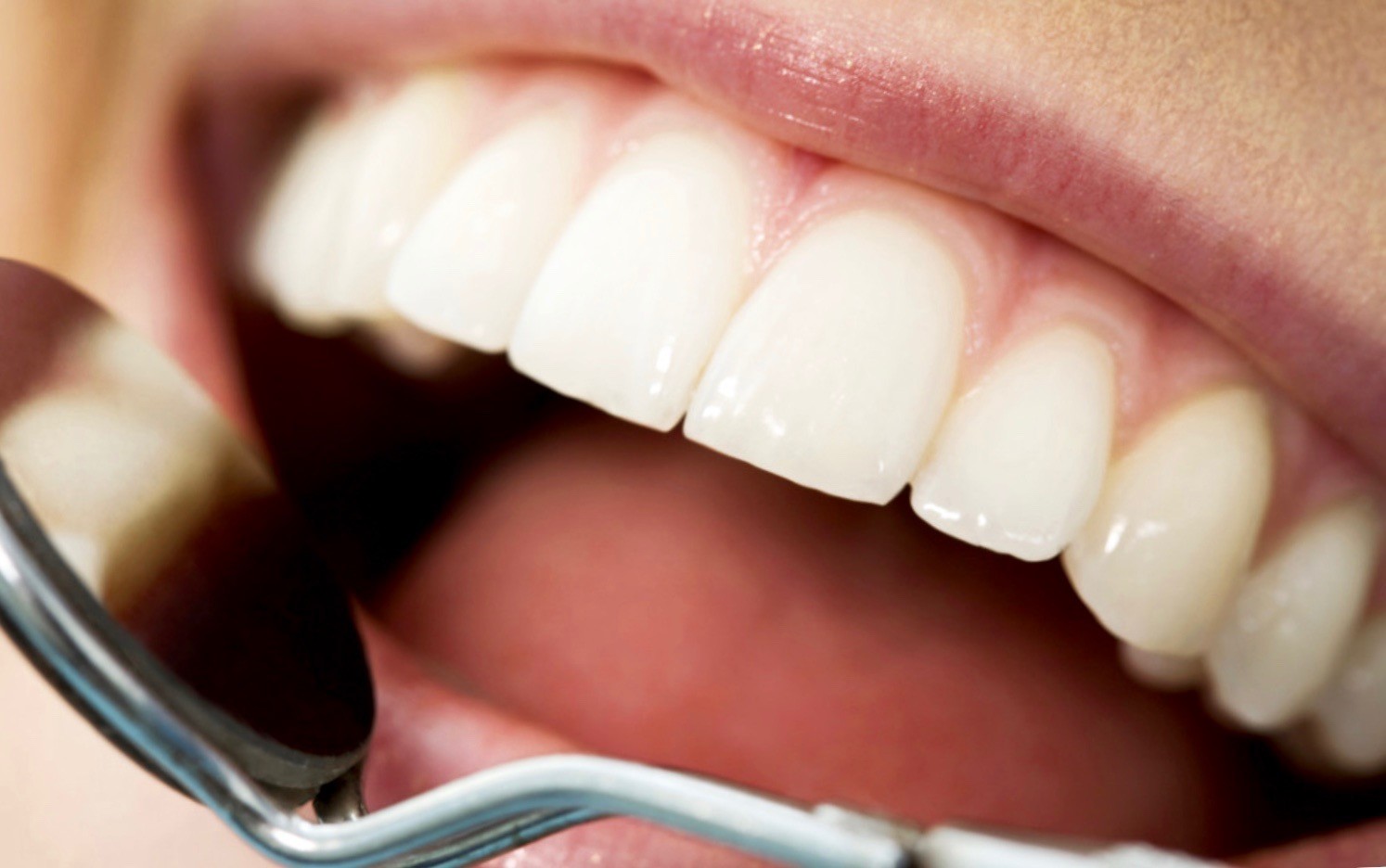 Cosmetic-Periodontal-Surgery