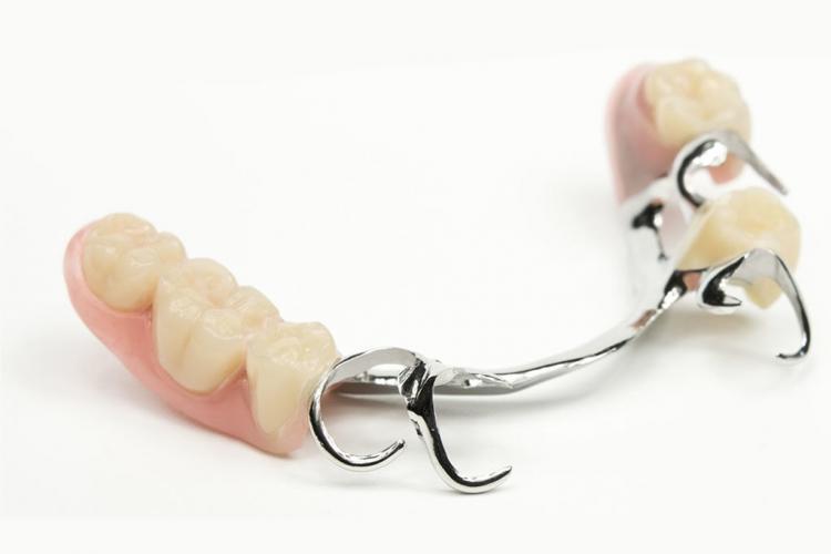 partial dentures vancouver bc