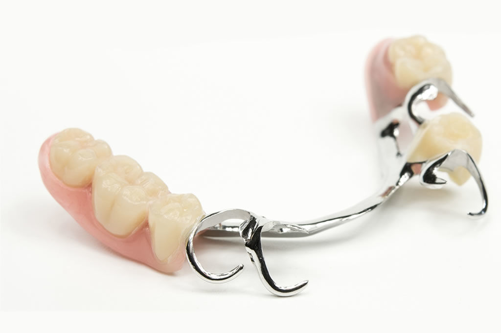 partial dentures vancouver bc