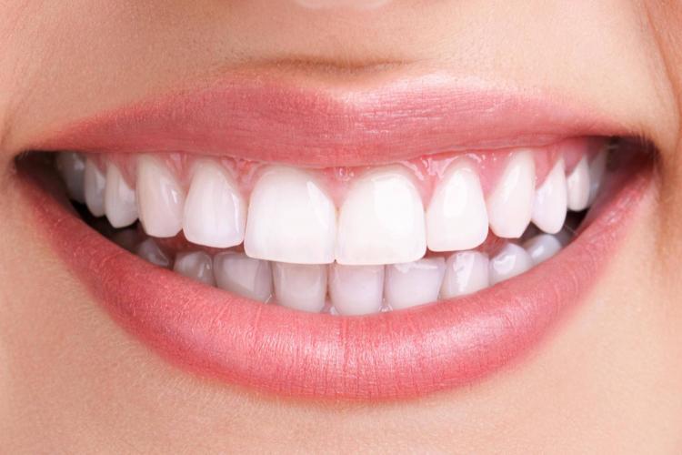 Teeth Whitening Vancouver BC