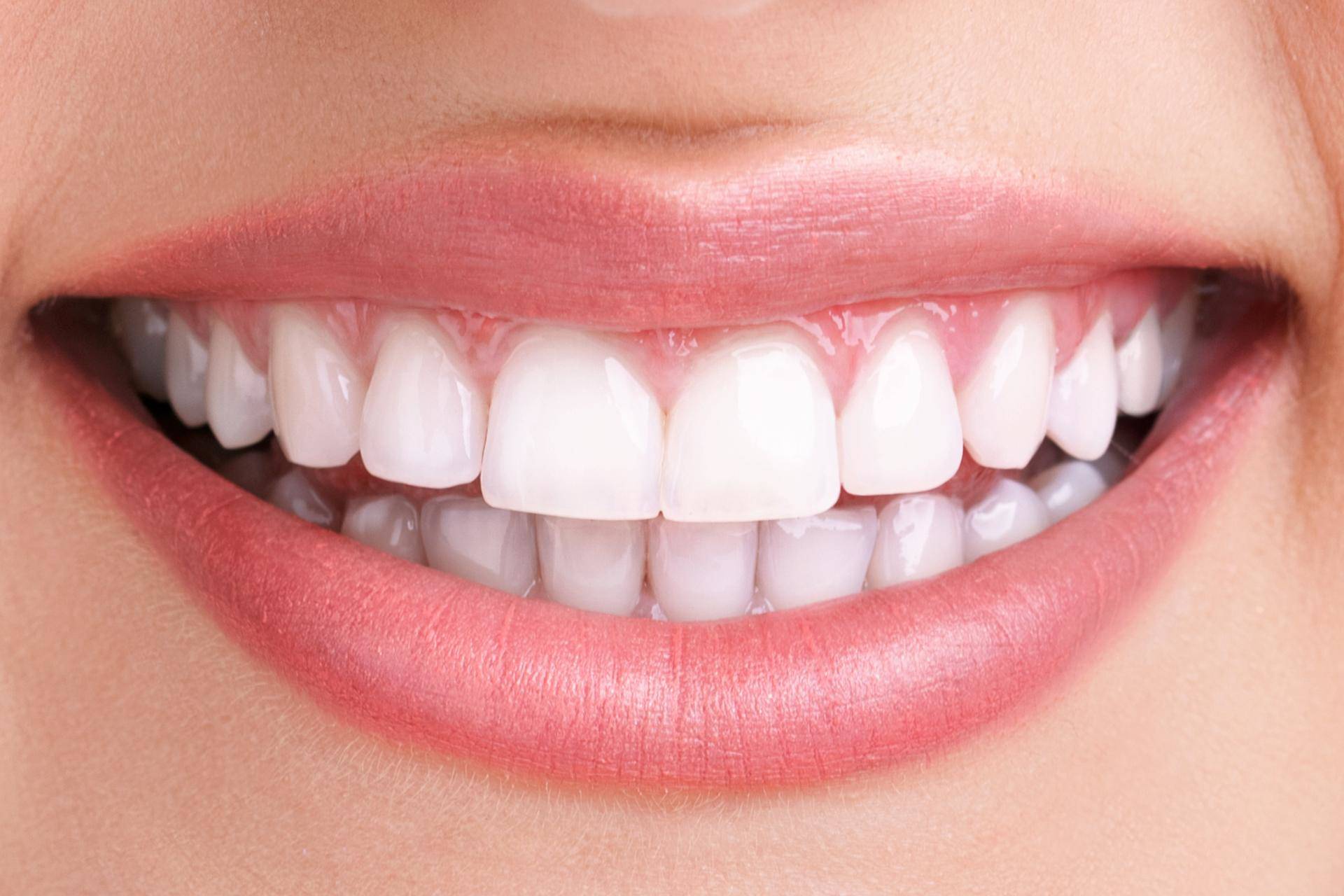 Teeth Whitening Vancouver BC