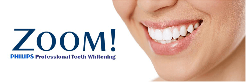 Zoom Teeth Whitening Vancouver