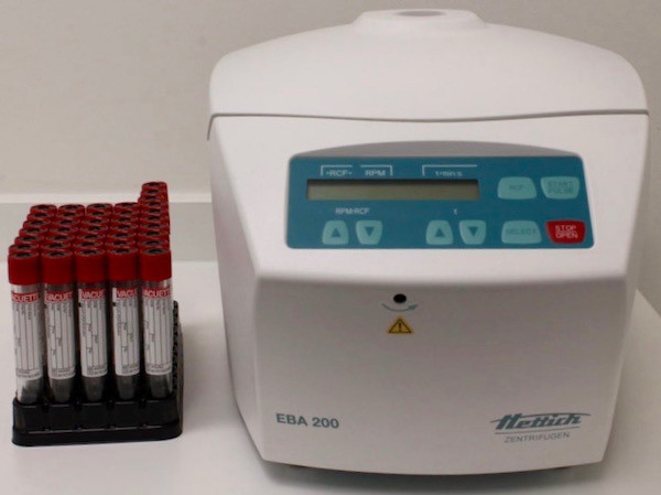 PRF Dental Equipment