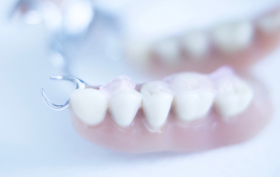 Dentures and Other Options