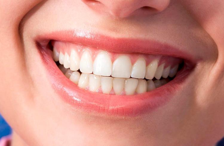 How to Get Better Looking Gums Vancouver