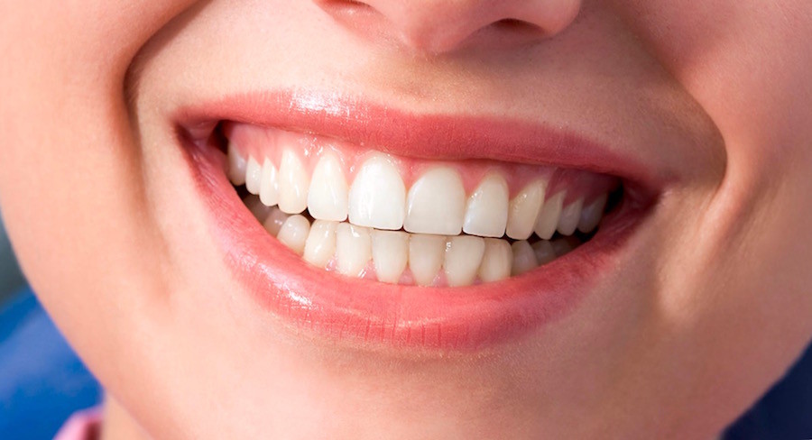 How to Get Better Looking Gums Vancouver