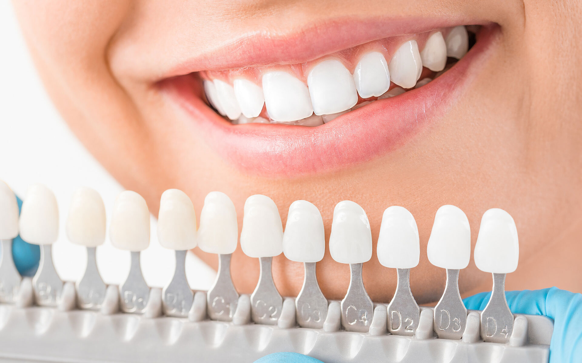 Tips to Take Care of Dental Implants