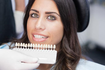 porcelain veneers