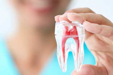 root canal vancouver bc