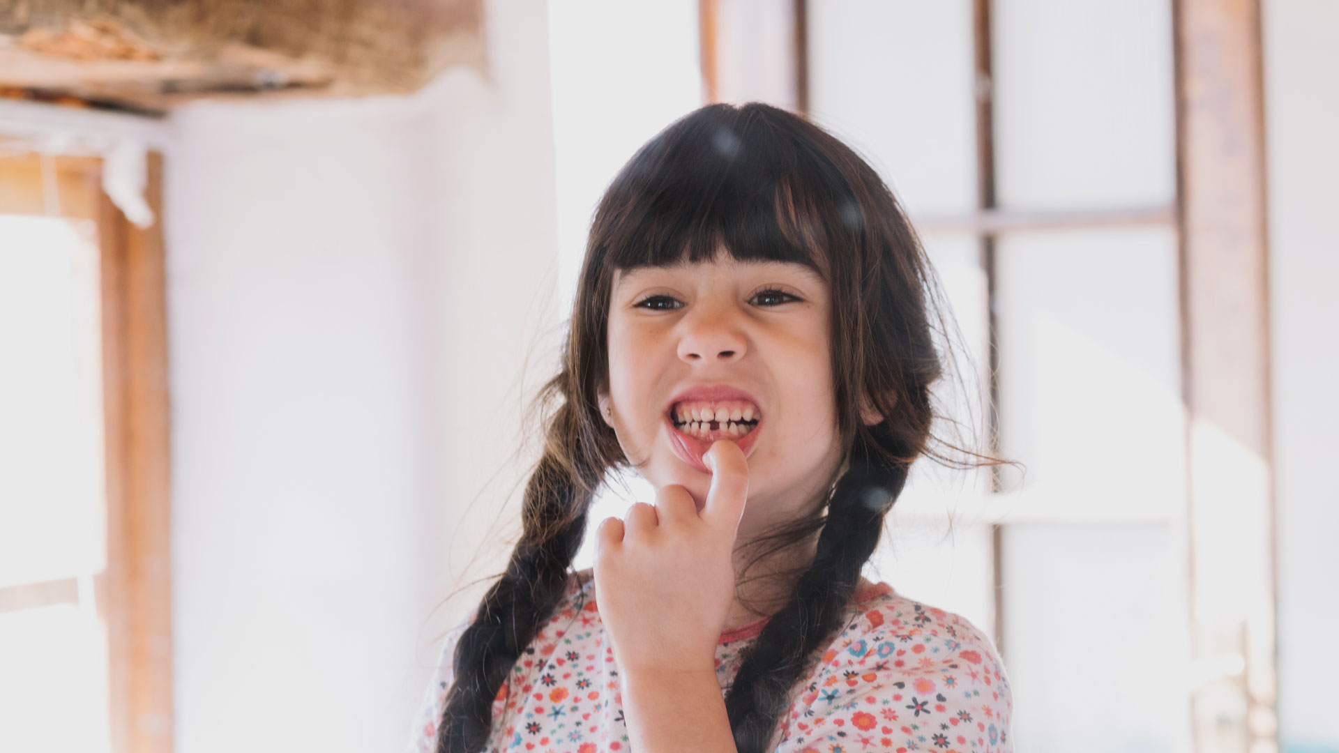 Hypodontia or Genetically Missing teeth