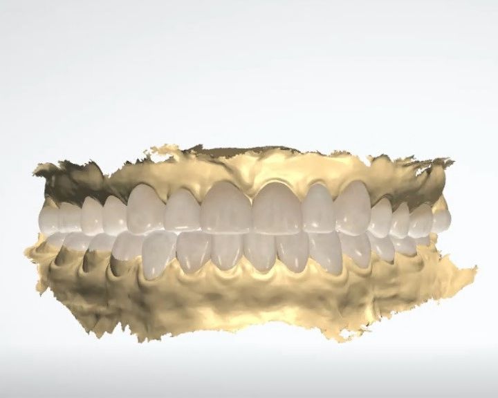 Ten Essential Factors to Consider for a Smile Makeover